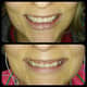 Slider image (9) Dr. Aleksandar Kovacevic - Dental Clinic in Croatia